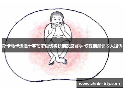 斯卡马卡遭遇十字韧带重伤将长期缺席赛季 恢复期漫长令人担忧